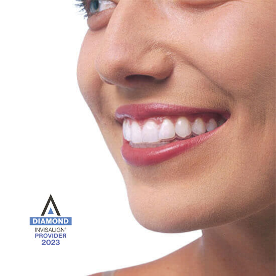 Diamond Invisalign provider